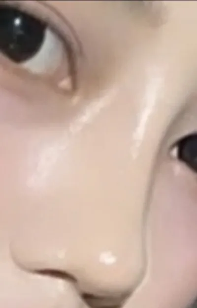 [鼻] メロンマンゴー - 鼻