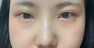 [鼻] ピンクパンダ - 目、鼻