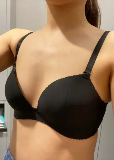 [豊胸] Lily - 豊胸