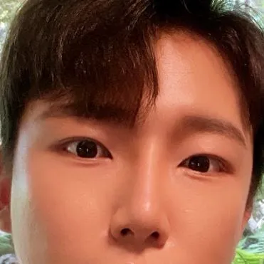 [男性] Aiden - 埋没法、目の下の脂肪再配置、鼻