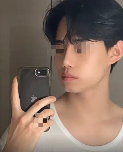 [男性] コムドル - 鼻 (美容+機能)