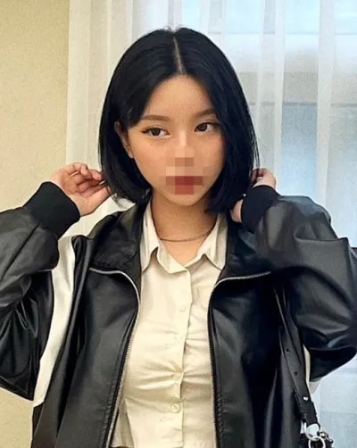 [輪郭手術] Asher - 輪郭2種