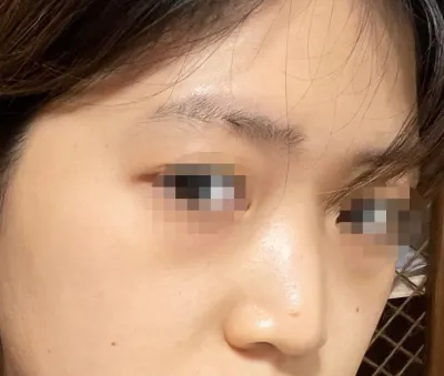 [目] スンデデラ - 目、鼻