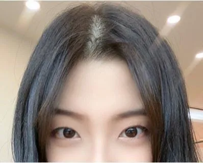 [目] コンペイ - 目