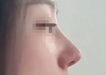 [鼻] ミンちゃん - 鼻