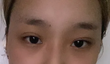 [鼻] メロディー - 輪郭、目、鼻