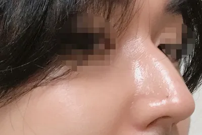 [鼻] ロボット - 鼻