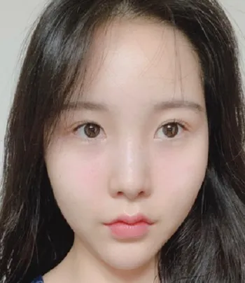 [鼻] コグンコグミ - 鼻