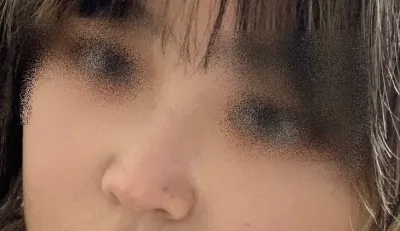 [鼻] チョラスルv - 鼻