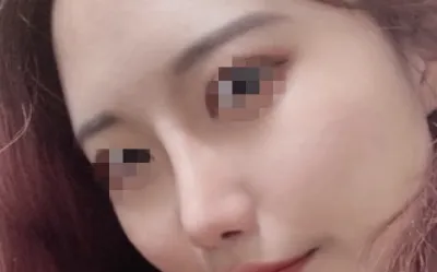 [鼻] ムンムンイ - 鼻