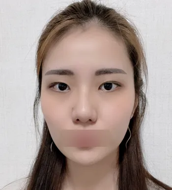 [輪郭手術] ありがとうございます - 輪郭