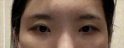 [目]すべて - 目