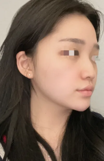 [鼻] ドゥドゥムチッ - 鼻