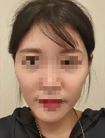 [輪郭手術] しっとりした国のチョコチップクッキー - 輪郭手術