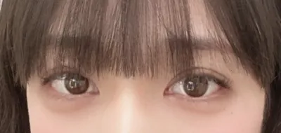 [目] コンドゥロロ - 目