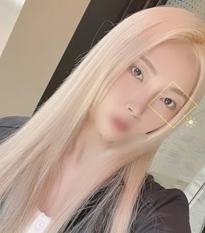 [鼻] エリシャ - 鼻、目の下の脂肪再配置