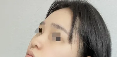 [鼻] 季節のように - 鼻