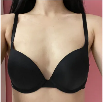 [豊胸] ヤンニャン - 胸