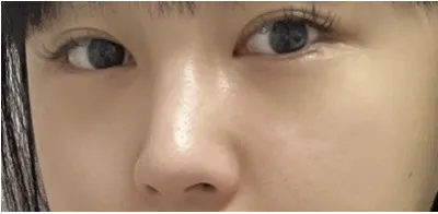 [目] 赤い糸 - 目、鼻