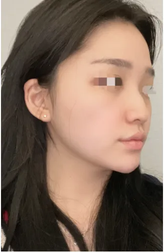 [鼻] ラブユー - 鼻