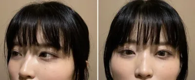 [鼻] すっきりとした鼻 - 鼻