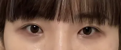 [目] ポッピピッポ - 目