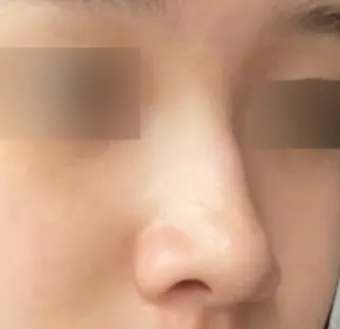 [鼻] ガリーブ - 鼻