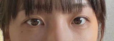 [目] ルビロン - 目