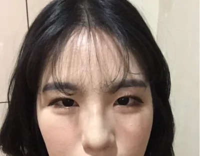 [目] チョクチョクハンチョコチップ - 目、鼻