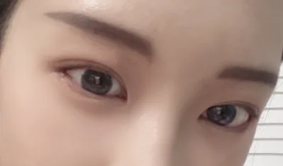 [目] ルディルーダ - 目