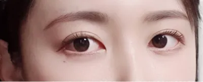 [目] ライアンチュンシク - 目