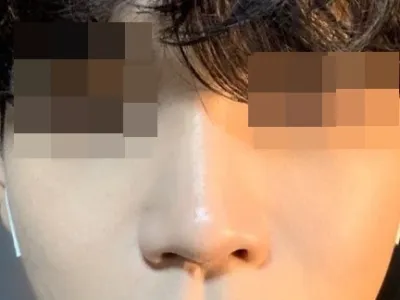 [鼻] チョンダウンウリチプ - 鼻