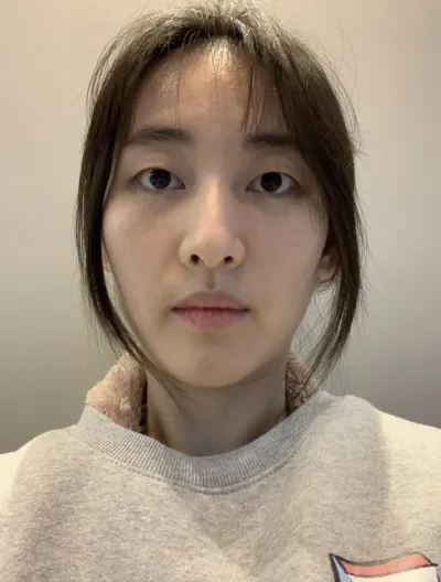 [目] パク・メンス - 埋没法、フィラー