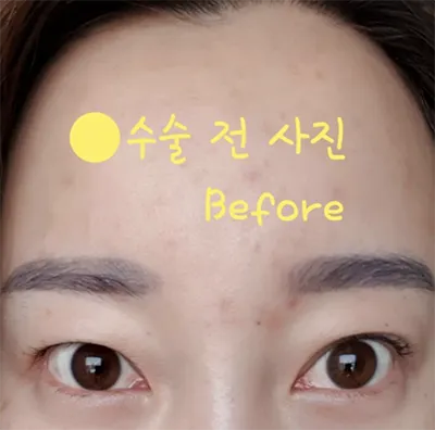 [目] アメショーヘア - 目