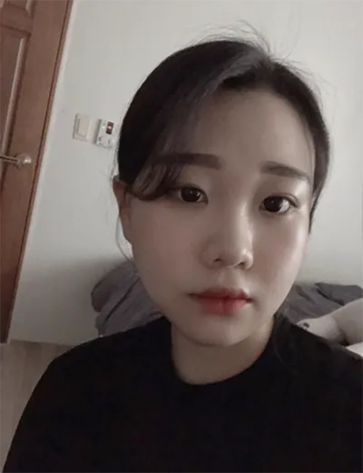 [輪郭手術] ニャニャニャニャン - 頬骨、エラ、顎先