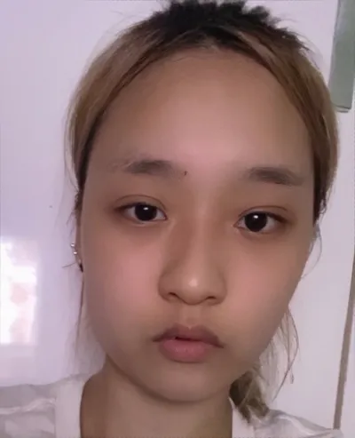 [目] タマネギクンヤ - 目、鼻