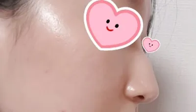 [鼻] ちょこん - 鼻