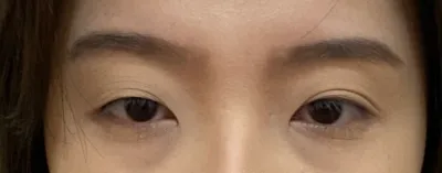 [目] ソンビ少女 - 目