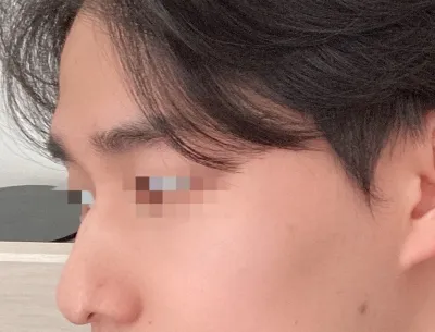 [鼻] クァンイ - 鼻