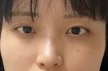 [目] 뽀삡뽀 - 目、鼻