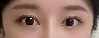 [目] 目整形 - 目