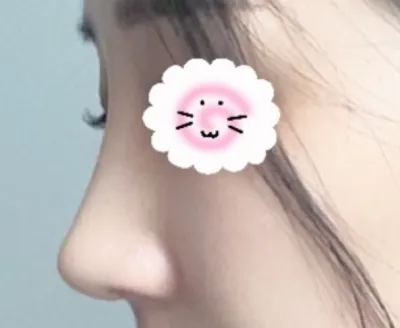 [鼻] 猫の楽園だ - 鼻