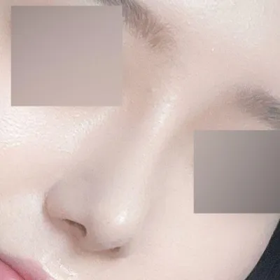 手術してもう1ヶ月になります