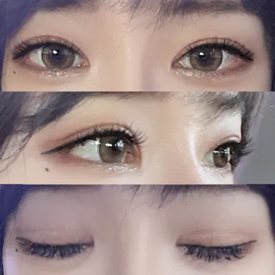 目の再手術をしてから4ヶ月が経ちました。