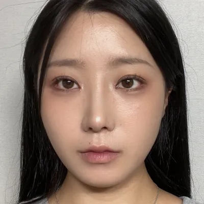 手術して1ヶ月目です〜