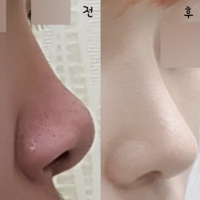 手術をして自信がつきました!!