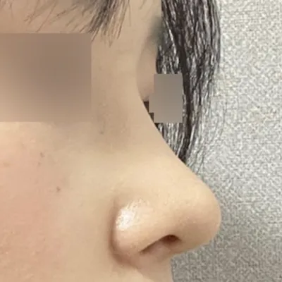 手術が本当にうまくいったようで、とても満足しています！