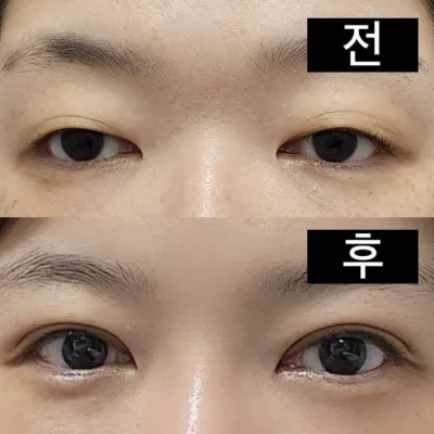 ラインが完璧に決まりました。