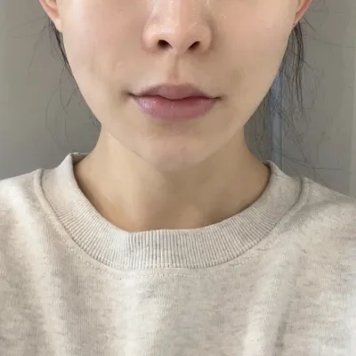 シルエットソフトは本当におすすめです!!