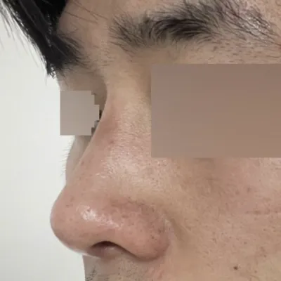 腫れが引いて、より自然になることを期待しています